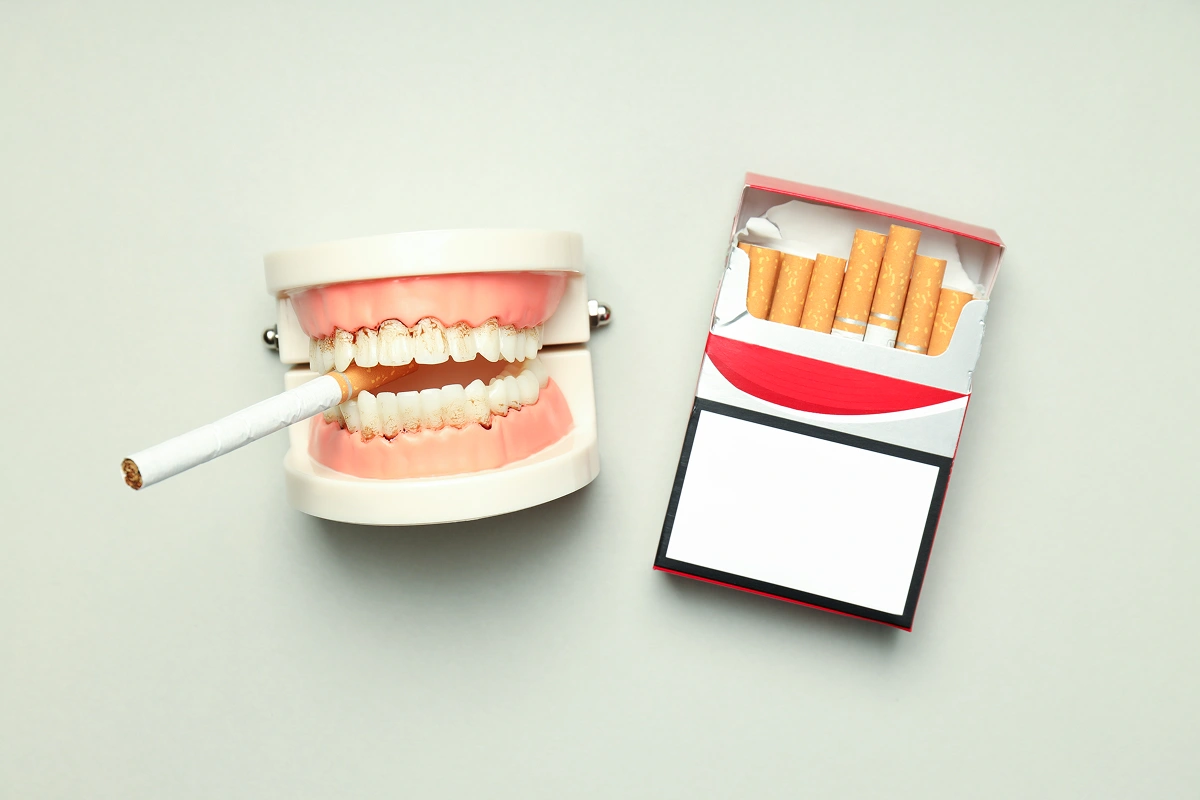 Is smoking the only lifestyle risk factor for gum disease